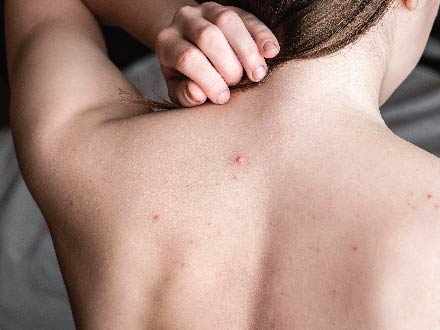 Revealing the Secret to a Spotless Back Types-of-acne-skiinaceclinic